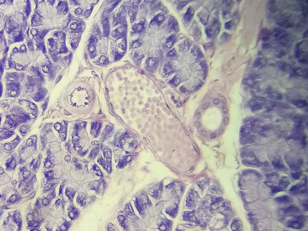 Pancreas Slides - Pancreas 012 400X